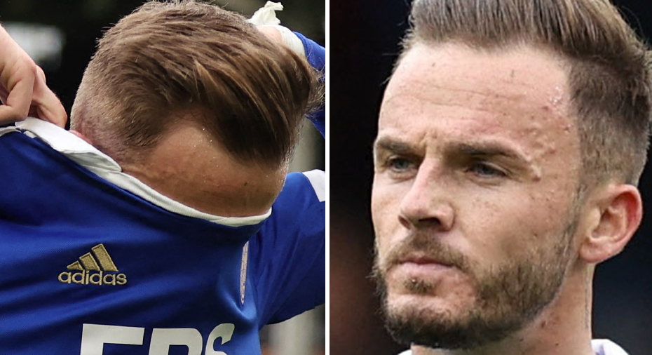 “Leicester’s defensive struggles continue in 5-3 loss to Fulham – James Maddison speaks out”